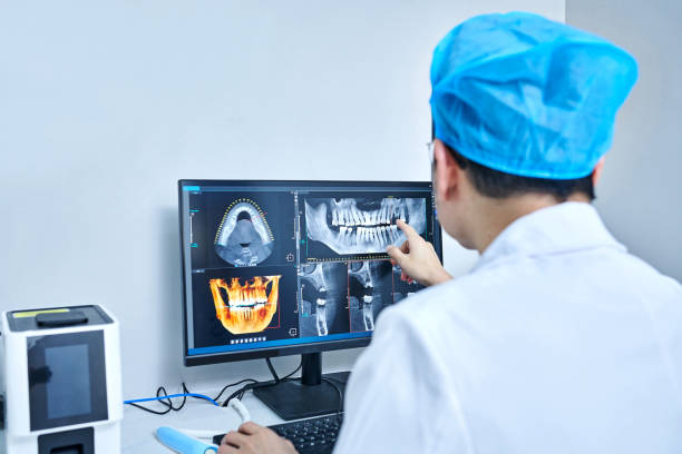 Best Emergency Treatment for Dental Infections or Abscesses in Lake Cherokee, TX